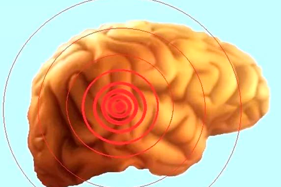 Глиосаркома головного мозга лечение народными средствами thumbnail