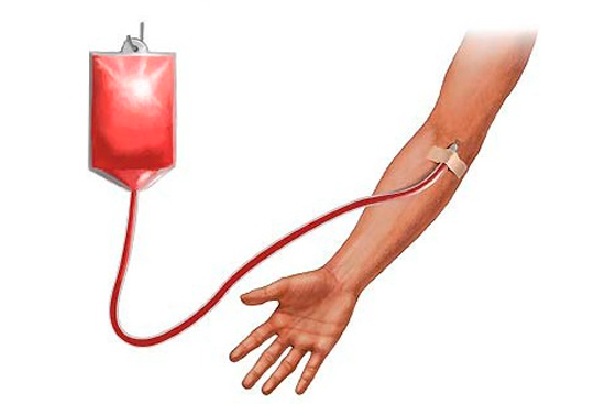 Переливание крови при онкологии: в каких случаях поможет?