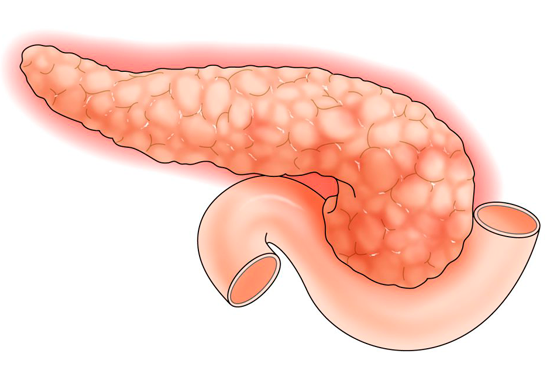 Рак хвоста поджелудочной железы первые симптомы thumbnail